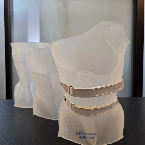 3d scolio brace